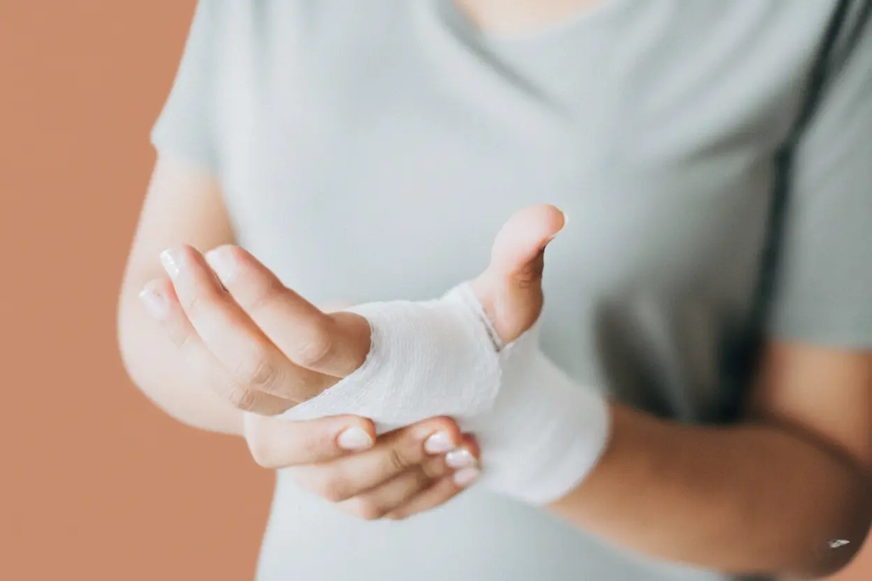 fracture du scaphoïde